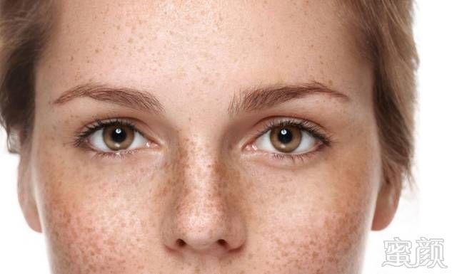 认识一下的因素造成的脸斑会产生不同的斑点怎么办