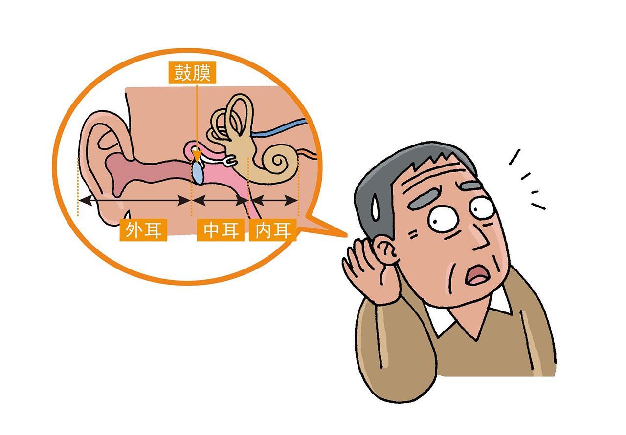 神经性耳鸣怎么分？你真的了解吗？