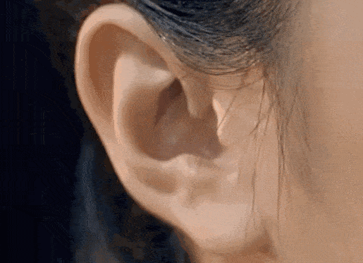 耳鸣贴穴位敷贴疗法快速直击耳鸣病灶根源，简单分为三步
